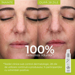 Ser „Elixir Vitis Vinifera Anti-Age”, Viorica Vie